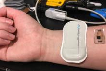 A prototype of a wearable medical device under development by Dr. Marvin Slepian