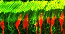 Rod and cone photoreceptors in a human retina. Photo courtesy of Dr. Robert Fariss, National Eye Institute, NIH