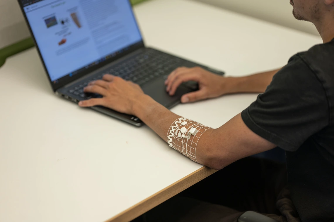 A man types on a computer while wearing a transparent arm cuff.